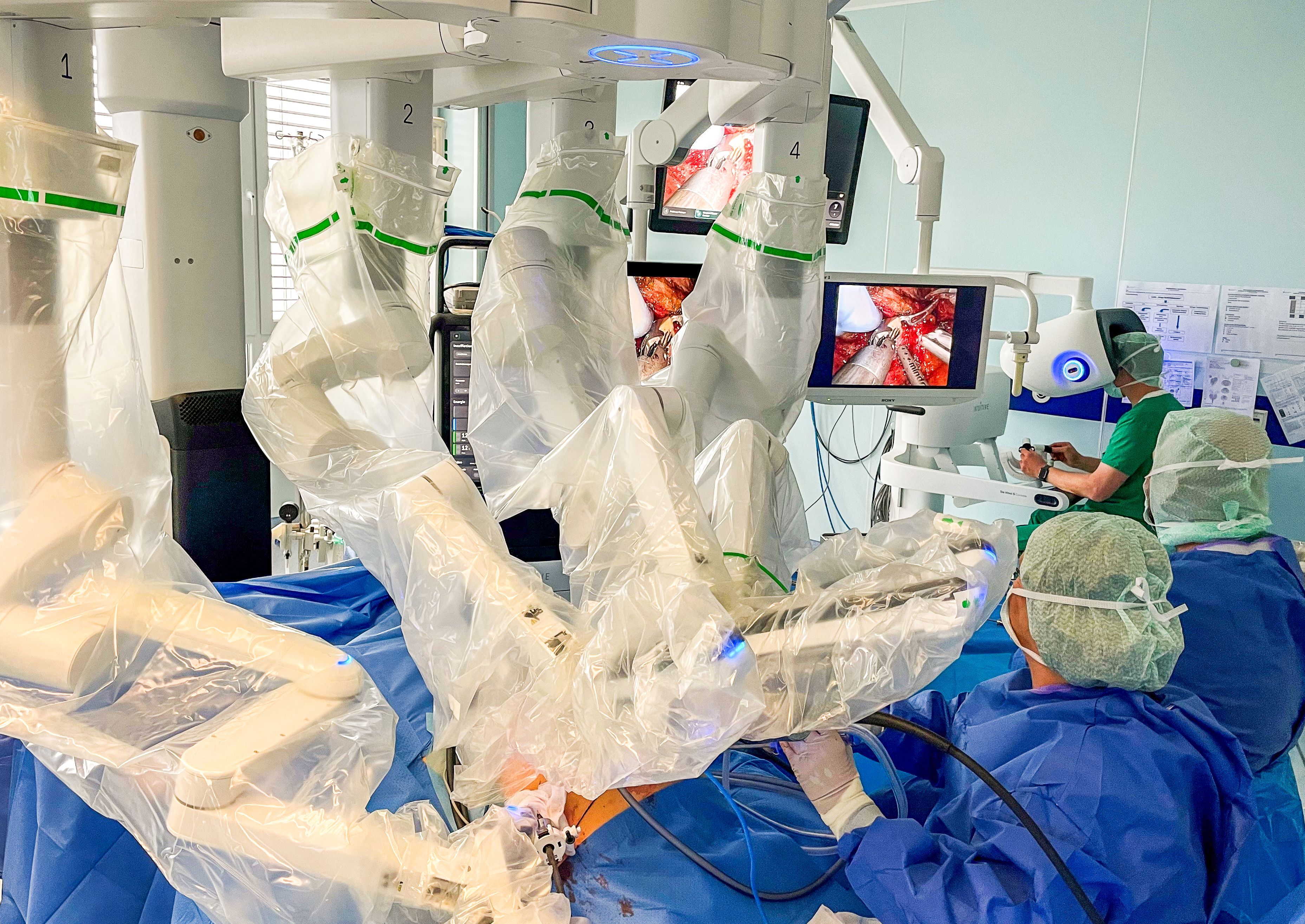 Ärzte im OP stehen am Tisch mit den Armen des neuen da Vinci 5 Roboter-Systems. Im Hintergrund der operierende Arzt an der Konsole. 
